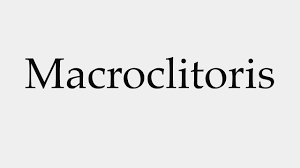 How to Pronounce Macroclitoris - YouTube