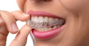 This may be upsetting, but it's normal. From Start To Finish What To Expect From The Invisalign Process