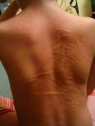 A great selection of clothing. Csalankiutes Es Etelallergia German Gyogytudomany