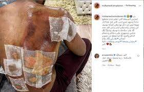 علق الإعلامي عمرو أديب، على الفيديو الذي ظهر فيه الفنان محمد رمضان ، ويدعي أن الدولة وضعت يدها على أمواله، قائلا: Ù…Ø­Ù…Ø¯ Ø±Ù…Ø¶Ø§Ù† Ù…Ù†ØªÙ‚Ø¯Ø§ Ø¹Ù…Ø±Ùˆ Ø§Ø¯ÙŠØ¨ Ø¥Ø¹Ù„Ø§Ù… Ø¨Ù„Ø¯ÙŠ ÙŠØªØ¬Ø§Ù‡Ù„ Ø¥ØµØ§Ø¨ØªÙŠ Ø­ÙŠØ§ØªÙ†Ø§ Ù…Ø´Ø§Ù‡ÙŠØ± Ø§Ù„Ø¥Ù…Ø§Ø±Ø§Øª Ø§Ù„ÙŠÙˆÙ…