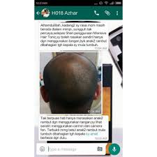 Masalah rambut gugur menjadi mimpi ngeri tidak kira wanita mahupun lelaki. Original Mensive Hair Tonic 60ml Tonik Pelebat Rambut Shopee Malaysia