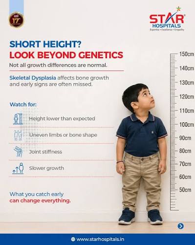 Maybe it's just genetics.” But what if it's not? Short height in children  isn't always normal. In some cases, it may be linked to conditions like  skeletal dysplasia, which affect bone growth