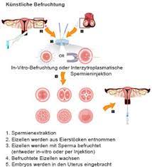 Check spelling or type a new query. Durch Kunstliche Befruchtung Zum Wunschkind Der Querschnitt De