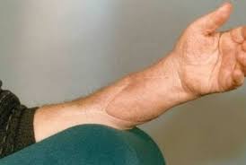 Mewarnai gambar juga dipercaya mampu meningkatkan konsenterasi dan fokus. Mahasiswa Buat Obat Antiinflamasi Dari Daun Meniran Dan Imer Republika Online