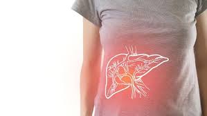 Check spelling or type a new query. Gejala Sirosis Kondisi Kronis Dari Penyakit Liver