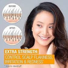 Amazon.com: Neutrogena Scalp Therapy Champú anticaspa extra fuerte, con 3%  de ácido salicílico, sin fragancia, 12 fl oz : Belleza y Cuidado Personal