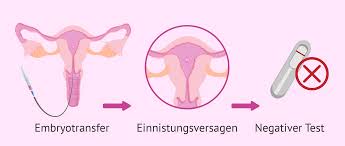 Würde mich über eine antwort freuen. Einnistungsstorung Des Embryos Ursachen Und Behandlung