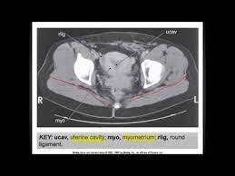 Check spelling or type a new query. The Pelvis Ct Anatomy Mp4 Youtube
