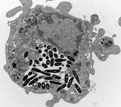 Image result for Legionella