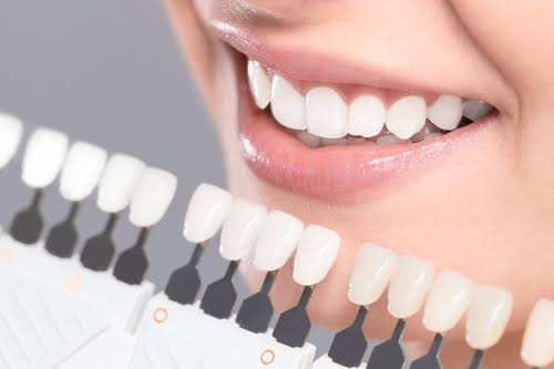 Improving Confidence and Smiles with Cosmetic Dentistry - Tahoe Family  Dentists