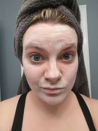 Santiago's skin has improved 100% since bringing him home, and it helps  that he love's his baths!! His favorite is getting exfoliated 😆 ❤️