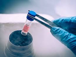 Stem Cell Therapy: What It Is and How It Can Help You | Avid Sports Medicine