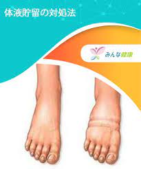 ボード デイサービス のピン