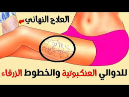 في الغالب، الدوالي لا تسبب ألما، على. 82 Ø·Ø¨ Ideas Ø·Ø¨ Ø¬Ù‡Ø§Ø² Ø§Ù„ØºØ¯Ø¯ Ø§Ù„ØµÙ…Ø§Ø¡ ÙˆØµÙØ© Ø·Ø¨ÙŠØ©