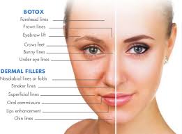 Are they aware of the side effects of dermal fillers (including blindness)? Facial Aesthetics Ashwell Dental Surgery