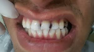 كم يبلغ الإنش بالسنتمترات؟ جواب : Ø¹ÙŠØ§Ø¯Ø© Ø³Ù…Ø§ Ù„Ø·Ø¨ Ø§Ù„Ø§Ø³Ù†Ø§Ù† Ø²Ø±Ø§Ø¹Ø© Ø§Ù„Ø§Ø³Ù†Ø§Ù† ØªØ¬Ù…ÙŠÙ„ Ø§Ù„Ø§Ø³Ù†Ø§Ù† ØªØ¨ÙŠØ¶ Ø§Ù„Ø§Ø³Ù†Ø§Ù† Ø¯ Ù…Ø­Ù…Ø¯Ø¹Ù„ÙŠ Publicacoes Facebook