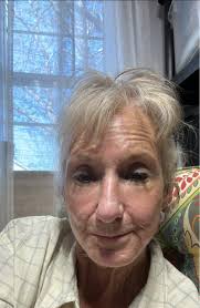 Introduction and Life After Retirement as a Retired ER Nurse