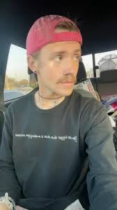 Overcoming Anxiety with Self-Compassion