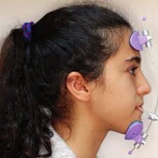 Demographic data and cephalometric measurements showing no significant...