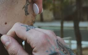 Sindromi reattive da solfiti una sindrome asmatica può essere indotta frequentemente anche dai solfiti (e220, e228), largamente utilizzati nell'industria alimentare, per le loro proprietà antisettiche ed antiossidanti, in vini, birre, formaggi, bevande alcoliche, succhi di frutta, frutta secca, crostacei e soprattutto preparazioni di patate, in particolare nelle patate surgelate a pezzi per. Dermatite Allergica Da Tessuti Cause Sintomi Test E Cosa Fare Naturalogico