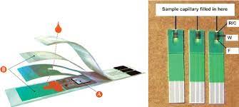 Alere g1 glucometer with 25 test strips multicolor blood clucose monitoring. Cross Section Of A Commercial Strip For Self Testing Of Blood Glucose Download Scientific Diagram