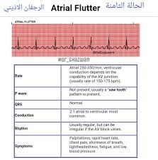 شرح تخطيط القلب الكهربائي Ecg وتحديد الحالة من رسم القلب أسرار دوت إنفو