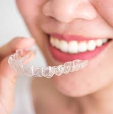 No monthly visits, no ridiculous costs. How To Straighten Teeth