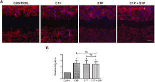 Find adidas f50 2010 from a vast selection of soccer. Ceramide 1 Phosphate Promotes The Migration Of Retina Muller Glial Cells Sciencedirect