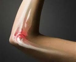 سرطان العظام كانسر العظام الأسباب الأعراض وطرق العلاج