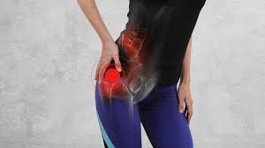 They are often overlooked and underdiagnosed. Maigne Syndrome Sciatica Of The Thoraco Lumbar Junction Illinois Chiropractic Society