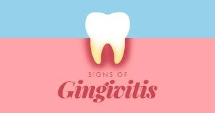Image result for Gingivitis