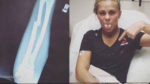 View complete tapology profile, bio, rankings, photos, news and record. Paige Van Zant From The Ufc Breaks Arm 100 3 Wheb Roadkill