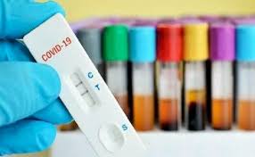 Apa Itu Rapid Test Dan Swab Covid 19 Desa Demulih