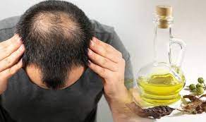 Hair loss oil for private label natural pure anti hair loss treatment products hair growth spray oil for men and women hair growth oil. Hair Loss Treatment Amla Oil Proven To Help With Significant Hair Growth Express Co Uk