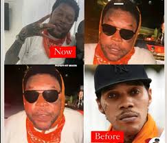 20×××××Years are Himmel's death