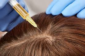But with prfm, rather than directly injecting that plasma into your scalp, the doctor transfers it into a separate vial laced with a calcium chloride solution. Prp Injection Fixhair Istanbul