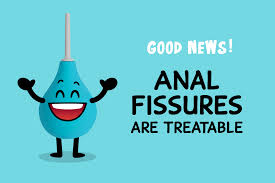 Anal fissures are treatable - San Francisco AIDS Foundation