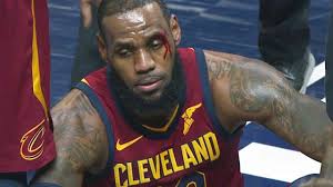 Rarely do injured nba stars sit on the bench during the game if. Lebron James Injury Cavaliers Vs Pacers Game 6 April 27 2018 2018 Nba Playoffs Youtube