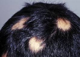 Pin On Hair
