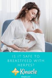 Is It Safe To Breastfeed With Herpes Kinacle