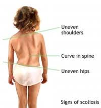 Image result for Low Back Standing Exam
