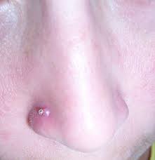 How To Get Rid Of The Bump On Your Nose Piercing Nose Piercing Body Piercings Piercing Bump
