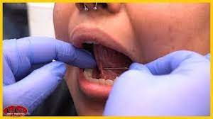 Web piercings on the tongue can last a lifetime but how long your tongue web piercing lasts may depend on the aftercare. Free Hand Tongue Web Piercing Youtube