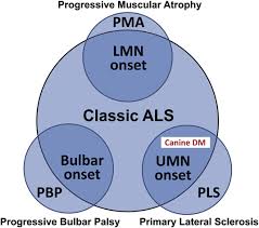 Image result for Progressive Bulbar Paralysis