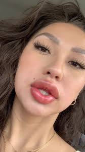 Faye Lips Before and After