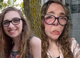 She survived the unthinkable — and chose compassion over anger. Just one  week ago, 65-year-old Jody Greer was brutally attacked while protecting her  beloved dog, Selene . Three dogs turned a peaceful