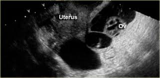 Pin On Ultrasound