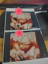 We did not find results for: Klinik As Salam Bandar Siber Ipoh Home Facebook