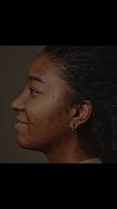 Maria Hamid (@aesthetiderm04) • Instagram photos and videos