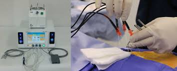 Image result for Radiofrequency Surgery